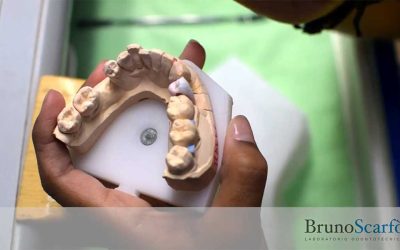 Faccette dentali, il futuro dell’estetica in odontoiatria?